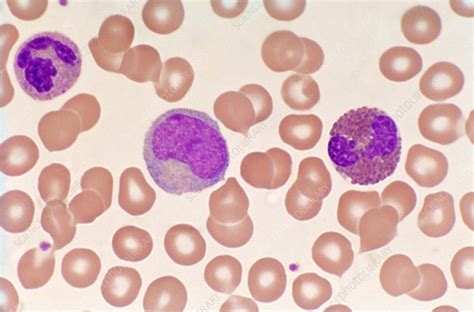 Blood Smear Model Labeled