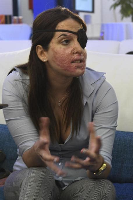 Notizie, foto e video su gessica notaro, tutti gli aggiornamenti da leggo.it. Gessica Notaro sfregiata con acido: 10 anni a Tavares, l ...