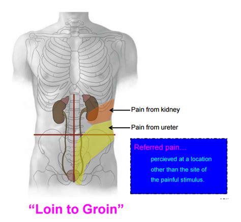Kidney Location On Back Pictures Kidney Failure Disease