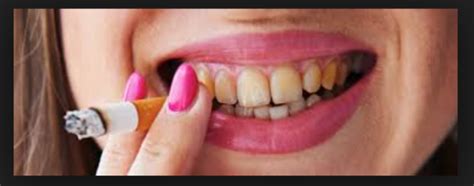 how does smoking affect your teeth dental clinic in nagpur dentist in nagpur