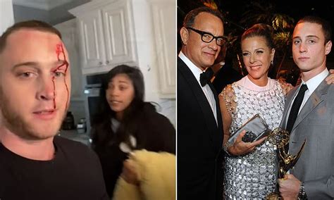 Chet hanks' patois accent at golden globes. Tom Hanks' son Chet accuses his ex of attacking him with a ...