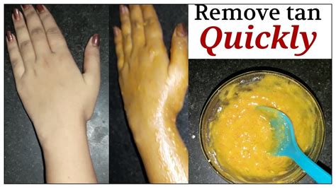 Remove Tan From Hands And Legs At Home Naturallyremove Tan Instantly