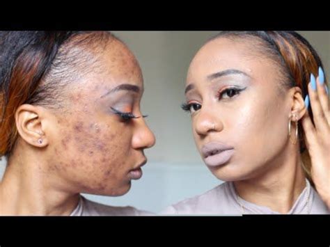 Determining the cause of the hyperpigmentation is important in selecting the best approach for. 5 Tutorials for Black Women on Using Makeup to Color ...