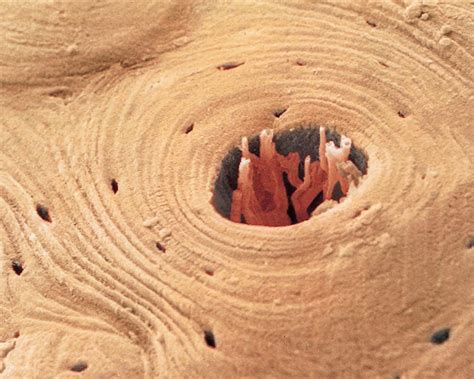 Cross section of compact bone. Pin on Health Science for Kids