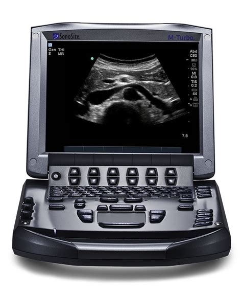 Point Of Care Ultrasound Among Top Tech Hazard For 2020 Says Ecri