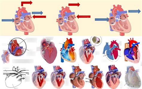 Cardiovascular Diseases Quizlet