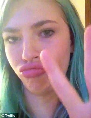 Kylie Jenner Challenge Sees Teens Suck Shot Glasses To Blow Up Their Lips Daily Mail Online