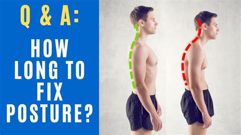 How Long Does It Take To Fix Your Posture Youtube