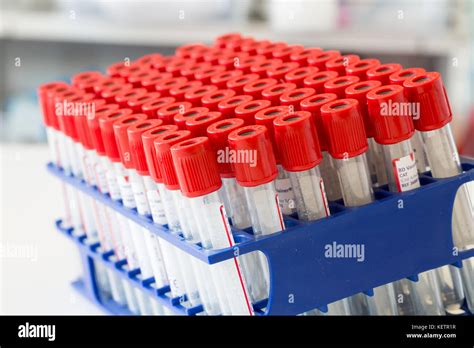 Vacutainer Blood Collection Tube High Resolution Stock Photography And