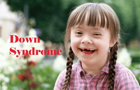 Down Syndrome Types Causes And Symptoms Learning Tree