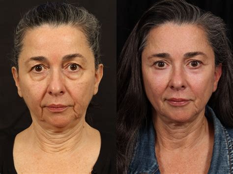 Full Face Permanent Makeup Before And After All You Need To Know All