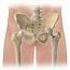 Hip Replacements May Require A Revision Why  Beacon Orthopaedics
