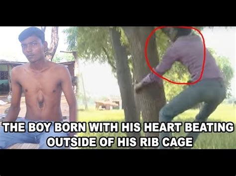 I have this feeling like there is something under my right rib cage as if something is stuck underneath or enlarged. THE BOY BORN WITH HIS HEART BEATING OUTSIDE OF HIS RIB CAGE - YouTube
