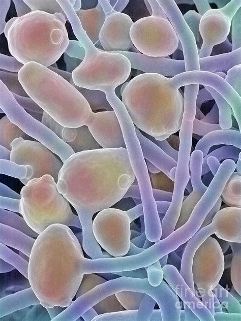 Candida Albicans Yeast And Hyphae Photograph By Dennis Kunkel