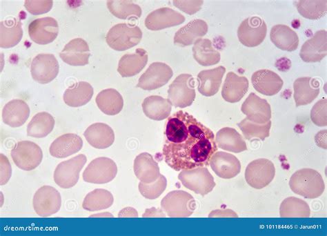 Eosinophil Cell Royalty Free Stock Photo 101184465