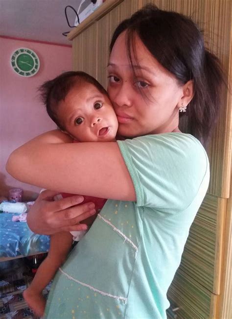 Biliary atresia is characterized by obliteration or discontinuity of the extrahepatic biliary system, resulting in obstruction to bile flow. Save Baby Kendra From Biliary Atresia : Liver Transplant ...