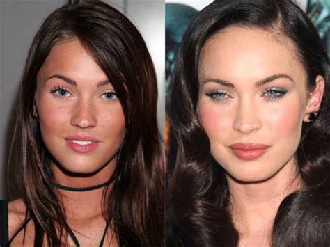 Aufgespritzte lippen wie gefährlich ist der instagram trend maintower. Megan Fox, Before and After | Megan fox plastic surgery ...