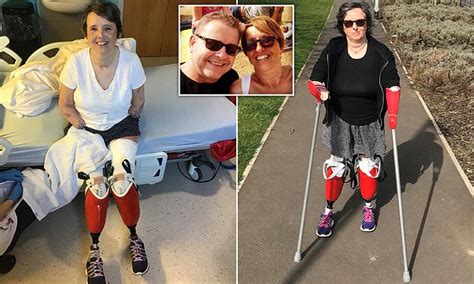 Mother Who Was Given Five Per Cent Chance Of Survival Loses Four Limbs