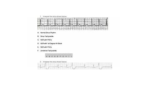 Ekg practice strips printable - Fill Out and Sign Printable PDF