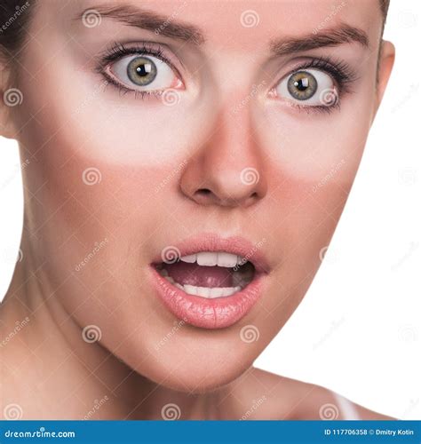 Young Surprised Woman With Sunburned Face Stock Photo Image Of Rays