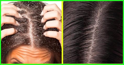 Common Hair Problems And How To Prevent Them Grapevine Birmingham