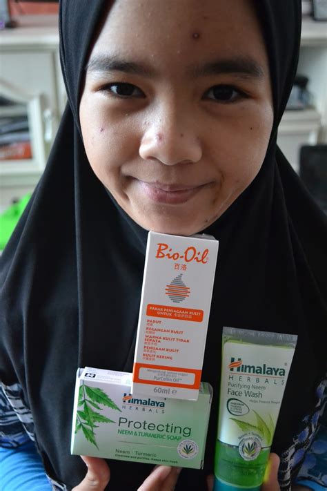 The name, chicken pox is vernacular for the varicella zoster virus. My Small World: Bukan sebarang chicken....