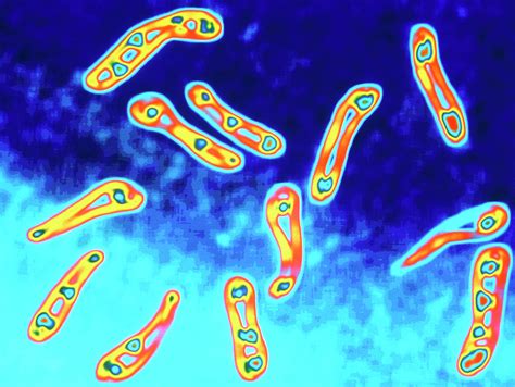 Corynebacterium Diphtheriae Bacteria Photograph By Alfred Pasieka