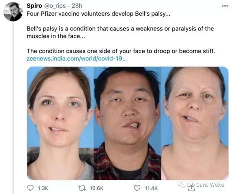 Apr 02, 2021 · 新冠mrna疫苗是第一种获得使用许可的mrna疫苗，但研制历史已有数十年，此前已开发过流感、寨卡病毒、狂犬病和巨细胞病毒（cmv）mrna疫苗。 我们再来看看mrna疫苗在细胞里的作用机制。 全球都在接种疫苗，您准备好了吗|疫苗|全球|灭活疫苗|mRNA|新冠病毒|刺突|图纸|-健康界