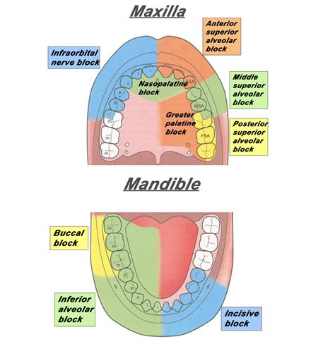 Inferior Alveolar Nerve Block Landmarks