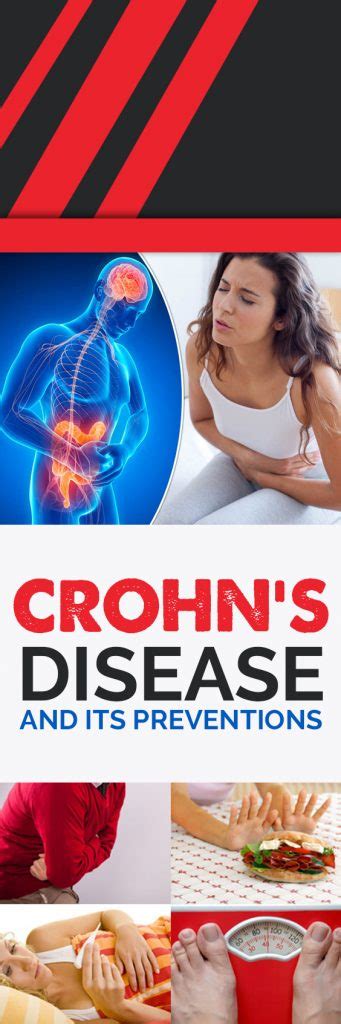 Crohns Disease And Its Preventions