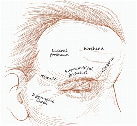 Forehead And Temple Reconstruction Plastic Surgery Key