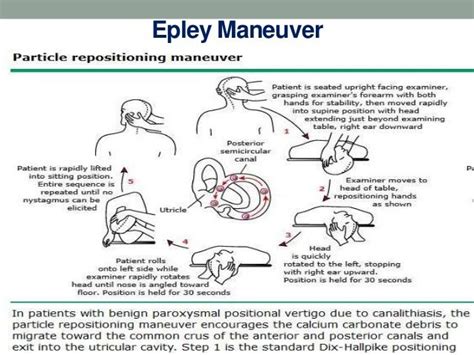 Kelly Boyson On Twitter Bppv Benign Paroxysmal Positional Vertigo