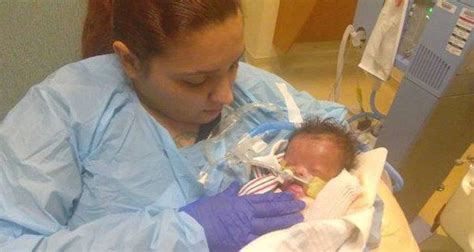 Baby Born Without Skin Struggles For Life In Texas Metro Voice News