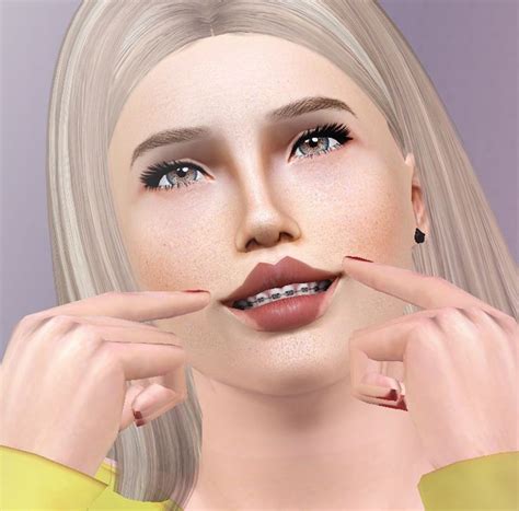 Eris Sims 3 Cc Finds Descargassims Teeth With Braces Female And