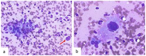 Diagnostics Free Full Text A Cytological Review Of Follicular