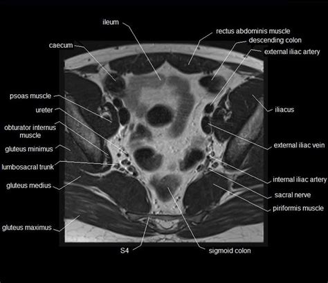 Included within the chart are gorgeous illustrations of the pelvic diaphragm, sphincter muscles, gluteus maximus. 28 best MRI MALE PELVIS images on Pinterest | Pelvis anatomy, Cross stitches and Crosses