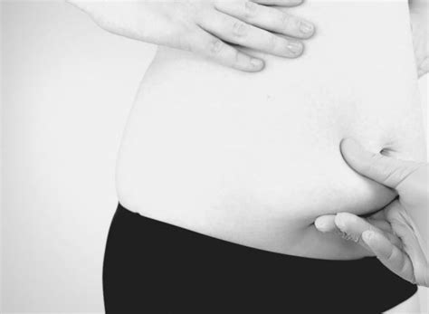 Comment savoir si on a besoin d une abdominoplastie 24h24 médecins