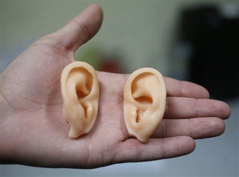 People With Tinnitus Or Ringing In The Ears Process Sounds Differently