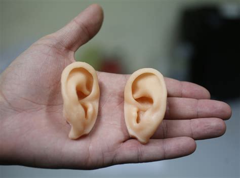People With Tinnitus, or Ringing in the Ears, Process Sounds