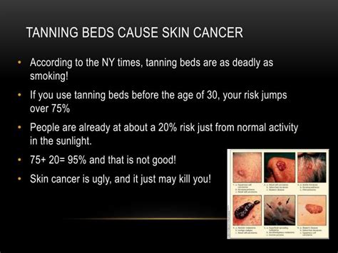 Ppt Tanning Beds Harmful Or Helpful Powerpoint Presentation Id