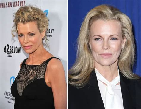 Kim Basinger Facelift Plastic Surgery Before And After Celebie