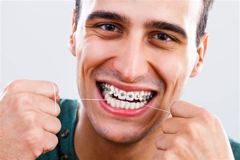 Benefits Of Orthodontic Treatments Vim Beget