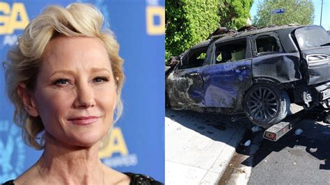 Anne Heche Reportedly Severely Injured After Car Crash