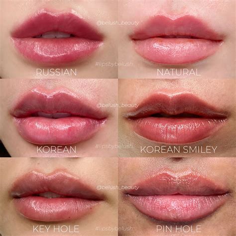 Lip Filler Belush Beauty The Lip Experts In Malaysia