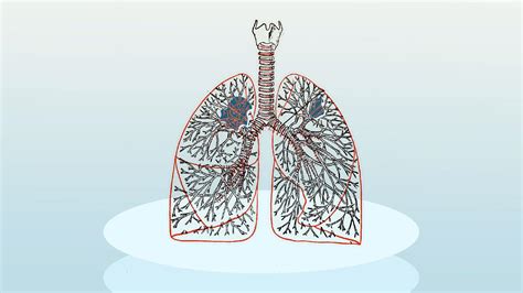 Aspiration Pneumonia Symptoms Causes Treatment Prevention