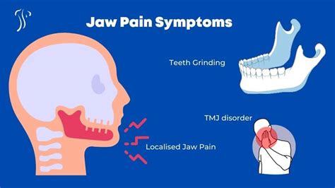 Jaw Pain Relief Tmj Pain Symptoms And Treatment Dublin