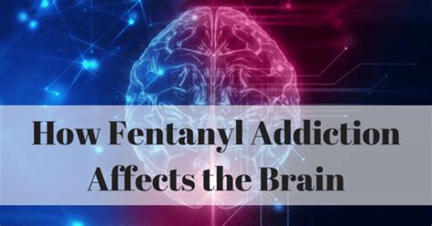 How Fentanyl Addiction Affects The Brain Amethyst Recovery Center