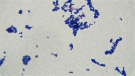 Lactobacillus Under Microscope 1000x Micropedia