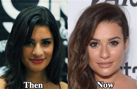 Lea Michele Nose Job Plastic Surgery Before And After Photos Latest