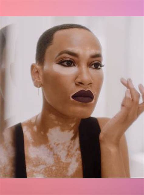 Covergirls Newest Model Has Vitiligo — And Just Made Beauty History